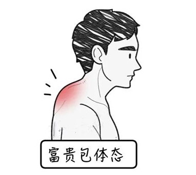 你还在低头玩手机？小心富贵包找上门