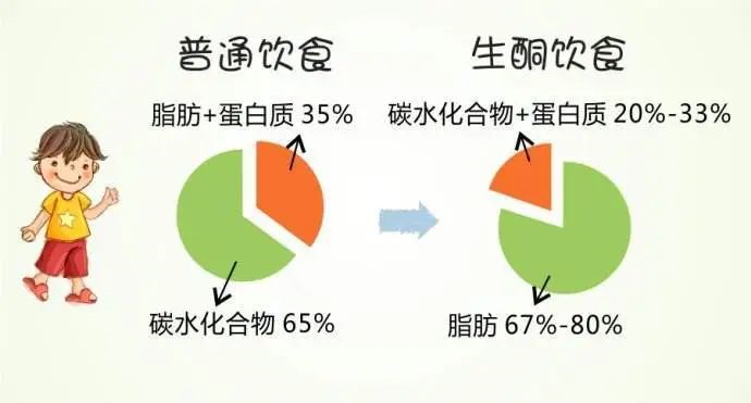 生酮饮食法