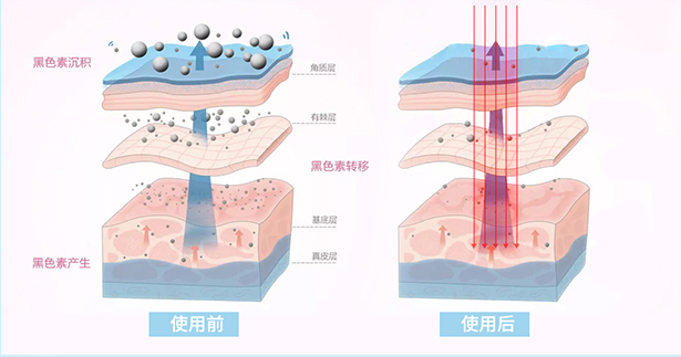 美白舱的原理与功效